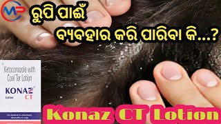 ରୁପି ପାଈଁ ବ୍ଯବହାର କରିବା Konaz CT Lotion Uses for Dandruff Psoriasis Skin infection Allergies Re [upl. by Nojel392]