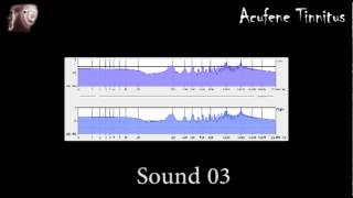 Sound 3  fast tinnitus relief  sollievo acufene rapido [upl. by Tildie]