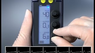 Sensing and Threshold Test — 53401 Temporary Pacemaker [upl. by Einnalem]