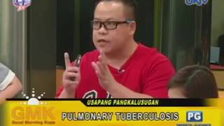 3 Signs of Pulmonary Tuberculosis [upl. by Russian]