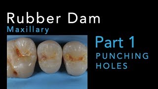 Rubber Dam Isolation Part 1 Punching Maxillary Holes [upl. by Lorrie671]