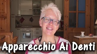 APPARECCHIO ORTODONTICO  Perché Solo Adesso e Prime Impressioni 1 [upl. by Notle]