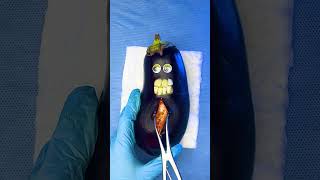 Emergency FruitSurgery Eggplant gives birth amp flatlines 🚑💉🩸 FoodSurgery ASMR [upl. by Urdna]