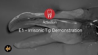 Helse Ultrasonic Endo  Activation  E1 Irrisonic Tip Demonstration [upl. by Anairol]