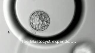 Blastocyst Development  Day 3 to Day 5 MUST SEE [upl. by Taveda]