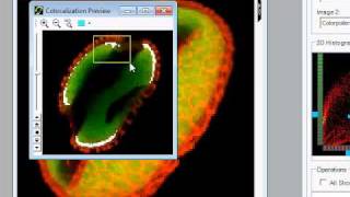 AutoQuant Colocalization tutorial [upl. by Hussein]