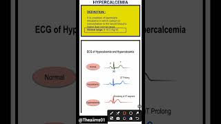 Hypercalcemia☑️hypercalcemiashortsaiimsnorcetmedicalcareerytshortsmedicalmsndisorders [upl. by Reddin]