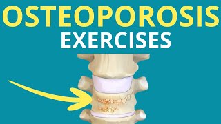 5 Exercises for Osteoporosis [upl. by Onaicnop]