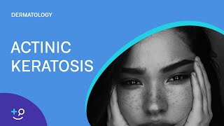 Actinic Keratosis Dermatology [upl. by Ahsinad]