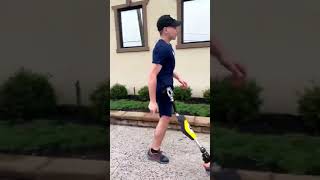 Hemipelvectomy Amputee Running with Prosthetic Leg  Kristofer [upl. by Jp]