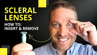 Scleral Lenses Insertion And Removal Plus Pro Tips For Beginners [upl. by Atsyrt]