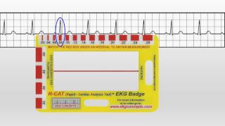 EKG Concepts  How To Use The EKG Badge [upl. by Janella518]