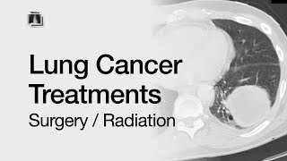 Lung Cancer Treatments Surgery  Radiation [upl. by Schulein938]