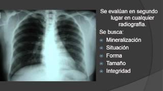 Fundamentos para Interpretación en Radiología General Simple [upl. by Kadner]