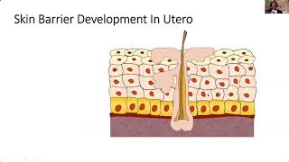 Neonatal Skin Development a Care [upl. by Abeh]