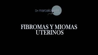 FIBROMAS Y MIOMAS UTERINOS [upl. by Thacker191]