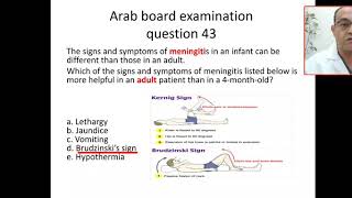 MCQ 43 neonatal meningitis sepsis Brudzinskis sign kerning nuchal rigidity [upl. by Lougheed]