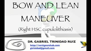 BOW AND LEAN MANEUVER RIGHT HSC CUPULOLITHIASIS [upl. by Victoir]