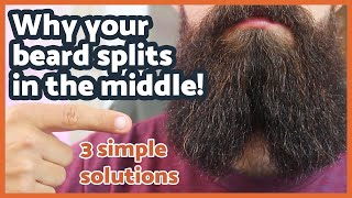 Why does my beard split in the middle 3 SIMPLE solutions [upl. by Tonye]