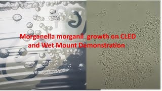 Morganella morganii Colony Morphology and Microscopy [upl. by Atiekahs]