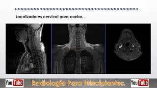 Protocolo básico de Resonancia Magnética de columna Dorsal [upl. by Dloreg238]