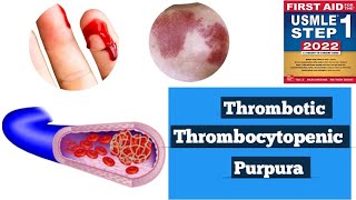 Thrombotic thrombocytopenic purpura TTPHUS Hematology lacturesDoctors goal [upl. by Azal]