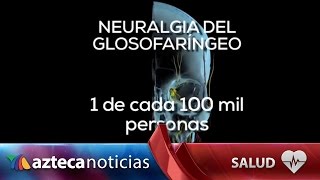 Dolor en el cuerpo el riesgo de padecer neuralgia [upl. by Aryan]