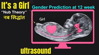 Early gender prediction I Nub Theory से जाने लड़का होगा या लड़की [upl. by Sato]