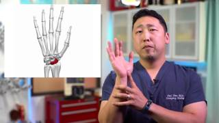 Learn Clinical Examination for Acute Traumatic Wrist Pain [upl. by Attenaj443]