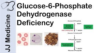 Glucose6Phosphate Dehydrogenase Deficiency  Symptoms Pathophysiology Diagnosis and Treatment [upl. by Makell668]