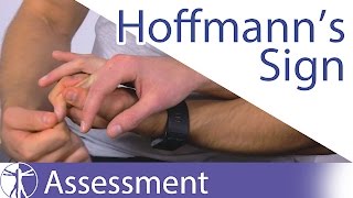 Hoffmanns Sign or Reflex  Upper Motor Neuron Lesion [upl. by Afrikah]