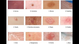 Skin Lesions with defination [upl. by Harat700]