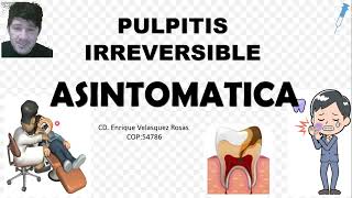 Pulpitis Irreversible Asintomática crónica [upl. by Yrreb]