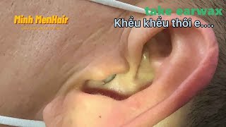 a s m r ear cleaning  耳掃除 水洗い  わんちゃん 耳掃除 earwax Ep 125 [upl. by Wenoa682]