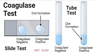 COAGULASE TEST PRACTICAL amp THEORY VIDEO 💥🦠 Coagulase Test for Staphylococcus aureus MLTclass 🩸 [upl. by Kerin]