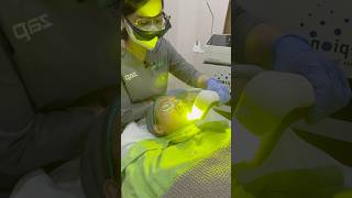 Treatment untuk bekas jerawat Yellow laser treatment zapcoid treatmentmurah [upl. by Nathanil]