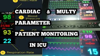 CARDIAC AND MULTI PARAMETERS PATIENTS MONITORING IN CRITICAL CARE UNITMEDICAL TECHNOLOGIST MT CCU [upl. by Atter]