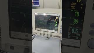 MAQUET SERVOI ventilator review biomedicalengineer [upl. by Adila]