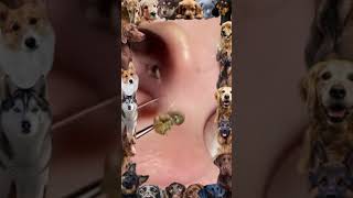 Blackhead Removal  Pore of winer 2024 blackheads [upl. by Nwahsal]