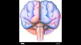 abnormal sulci and cisterns case review [upl. by Anitsihc610]