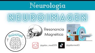 Neuroimagen  Resonancia Magnética [upl. by Ratha]