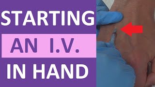 How to Start an IV  IV Catheter Insertion amp Flush Technique in Hand  Nursing Skill [upl. by Pall]