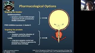 BPH Management in Elderly Patients  EMPIRE Urology Lecture Series [upl. by Akehsyt]