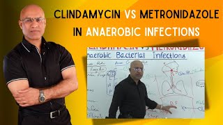 Clindamycin vs Metronidazole  Anaerobic Infections [upl. by Kokaras]