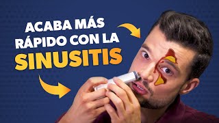 Cómo curar la SINUSITIS más rápido [upl. by Valentina237]