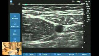 Ultrasound guided obturator and saphenous nerve block workshop [upl. by Nahshu224]