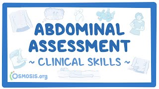 Abdominal Assessment Clinical Skills [upl. by Acirat]