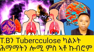 TBን Tubercculose ካልኦት ሕማማትን ሎሚ ምስ ኣቶ ኩብሮም [upl. by Hauge]