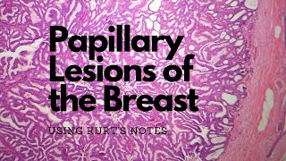 Papillary Breast Lesions 6 Main Entities using Kurt’s Notes pathagonia [upl. by Nekcarb]