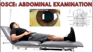 OSCE Abdominal Examination [upl. by Staley]